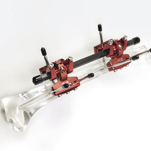 fixateur externe modulaire