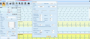 logiciel pour ECG