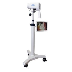 colposcope vidéo