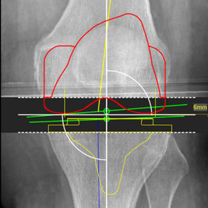 logiciel orthopédique