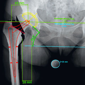 logiciel orthopédique