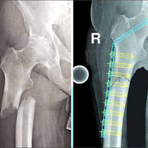 logiciel orthopédique