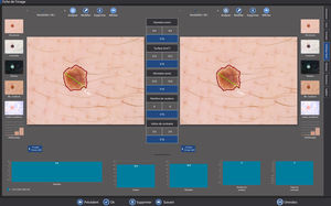 logiciel dermatologie