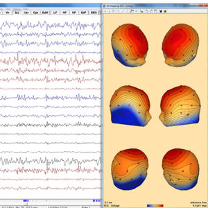 logiciel pour EEG