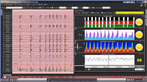 logiciel pour EEG