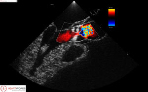 module logiciel pour échocardiographie