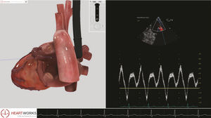 module logiciel pour échocardiographie