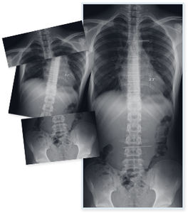 logiciel de radiographie