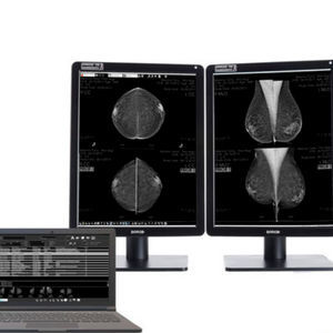 logiciel pour mammographie