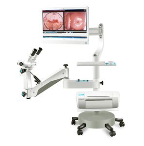 colposcope vidéo