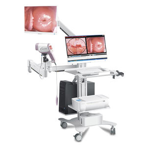 colposcope vidéo