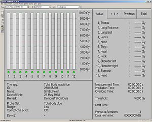 logiciel pour radiothérapie