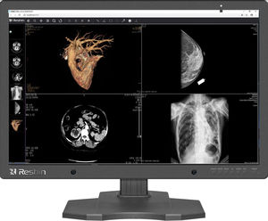 écran de diagnostic