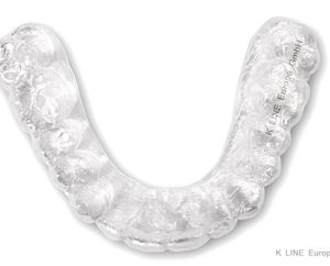 gouttière pour alignement dentaire