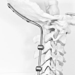 système d’ostéosynthèse occipito-cervical