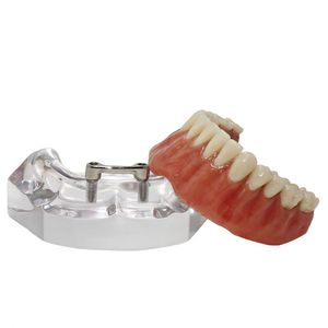 modèle anatomique de dentition