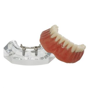 modèle anatomique de dentition