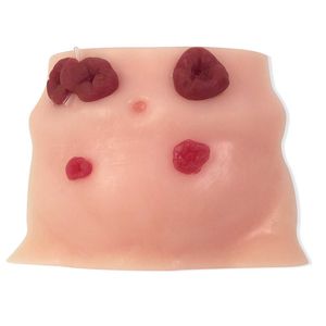 simulateur patient pour soins de stomies