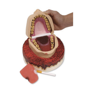 modèle anatomique de dentition / de gencive / de pathologie