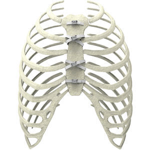 fil de cerclage orthopédique pour fermeture sternale