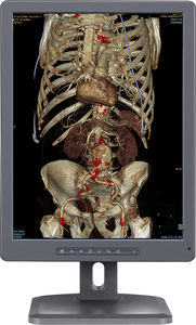 écran de diagnostic