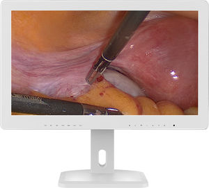 écran d'endoscopie