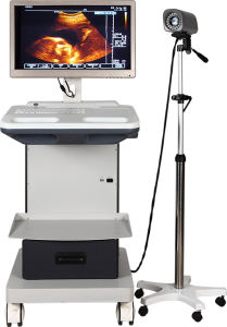 colposcope digital