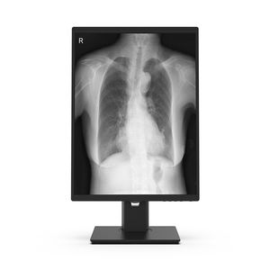 écran de diagnostic