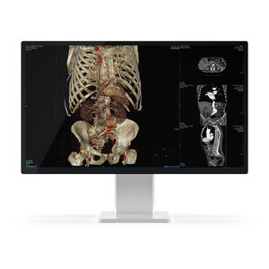 écran de diagnostic