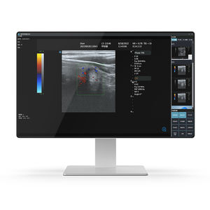 ordinateur médical Intel® Core i7