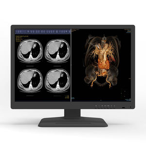 écran de diagnostic