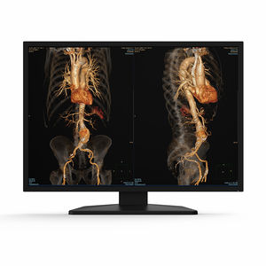 écran de diagnostic
