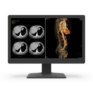 écran de diagnostic