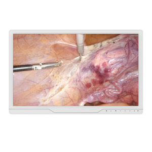 écran d'endoscopie