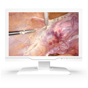 écran d'endoscopie