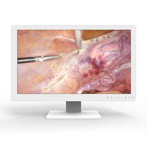 moniteur médical