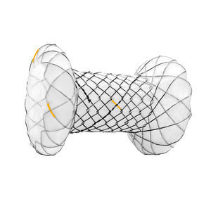 stent pancréatique