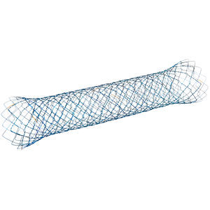 stent colique