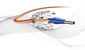 stent périphérique