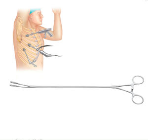 pince de chirurgie