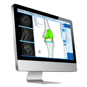 logiciel de planification / TDM / d'hôpital