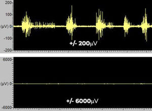 logiciel pour EMG