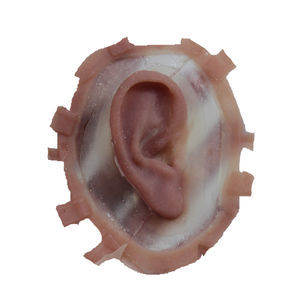 épithèse auriculaire