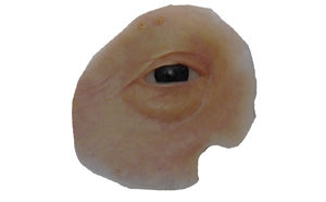 épithèse orbitale