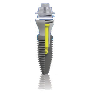 implant dentaire cylindrique