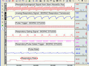 photopléthysmographe respiratoire