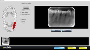 logiciel pour imagerie dentaire