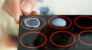 kit de test de coagulation
