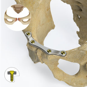 plaque de compression de pelvis