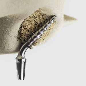 implant dentaire cylindrique